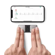 AliveCor KardiaMobile