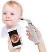 ScopeAround 5-in-1 Multipurpose Wireless Smart Otoscope