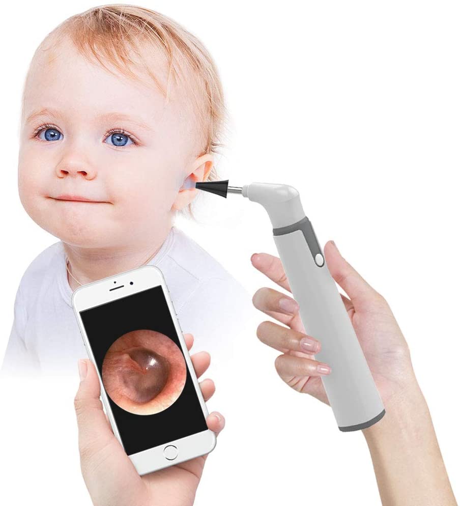 ScopeAround 5-in-1 Multipurpose Wireless Smart Otoscope
